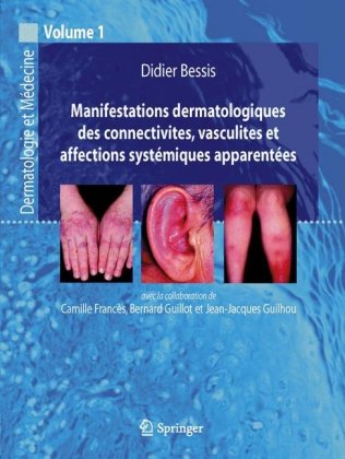 Manifestations dermatologiques des connectivites, vasculites et affections systémiques apparentées : Dermatologie et médecine