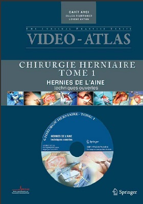 atlas Chirurgie herniaire: tome I: Hernie de l'aine, techniques ouvertes