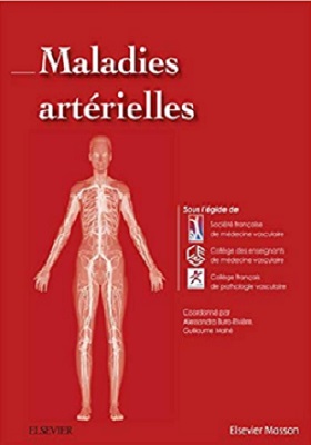 Maladies artérielles