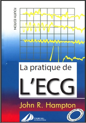 La pratique de L'ECG