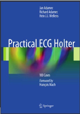 Practical ECG Holter:100 Cases