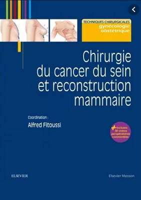 Chirurgie du cancer du sein et reconstruction mammaire: Reconstruction Mammaire