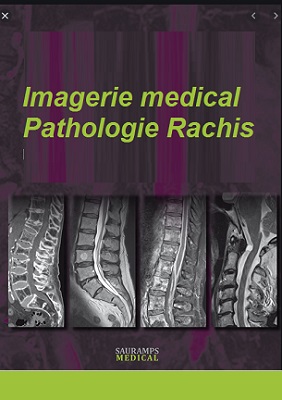 Imagerie médicale:Pathologie Rachis