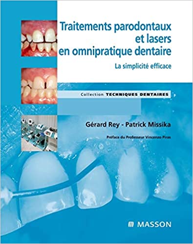 Traitements parodontaux et lasers en omnipratique dentaire:La simplicité efficace